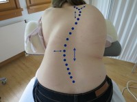 Skoliose_Mikrodehnung_MaRhyThe